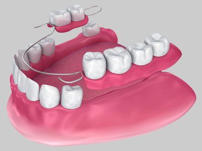 DENTURES / PARTIALS DENTURES